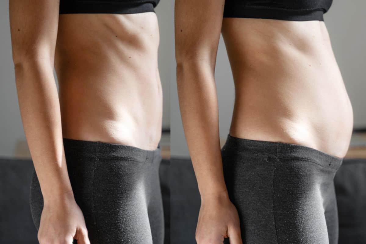 How long does diastasis recti take to improve Greater London (Haringey)?