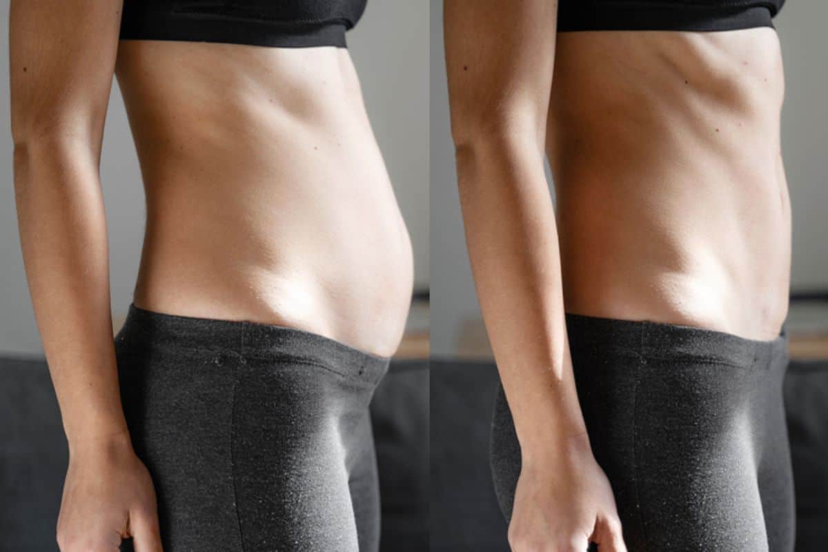 Post-Pregnancy: What Happens to Your Abdominal Muscles After Birth Greater London (Haringey)