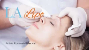 Woman receiving Actinic Keratosis Removal Treatment Greater London (Haringey)