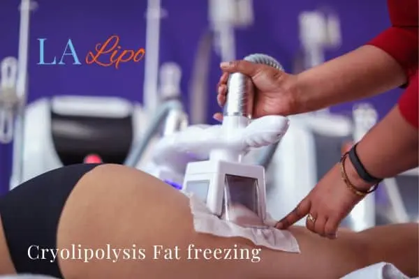 women getting fat freezing Greater London (Haringey)