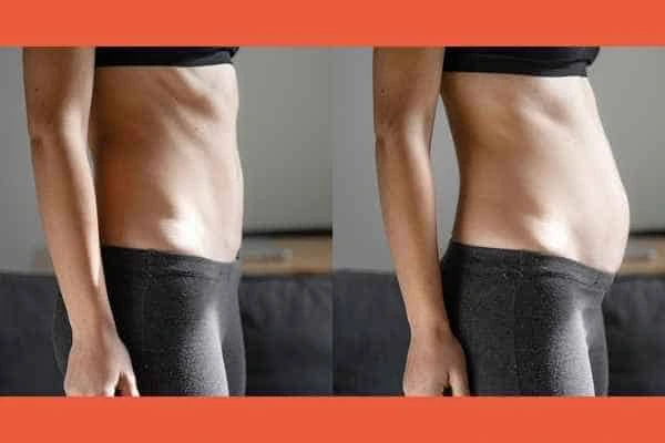 LA-EMS Body Sculpting results Greater London (Haringey)