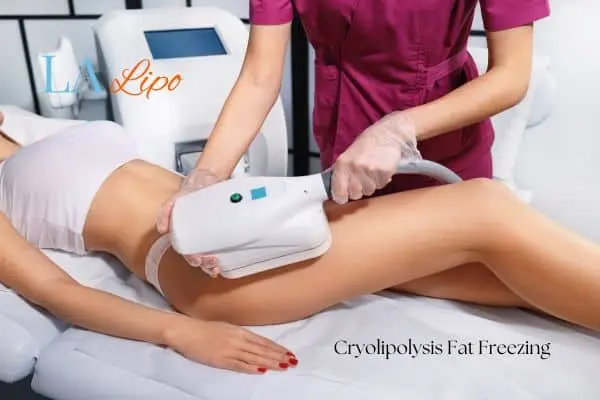 Woman receiving coolsculpting Greater London (Haringey) treatment on her thighs