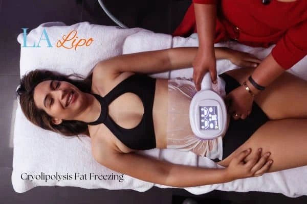 woman getting cryolipolysis Greater London (Haringey)