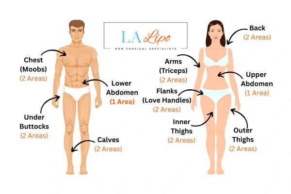 LA LIPO Cryolipolysis Areas Greater London (Haringey)