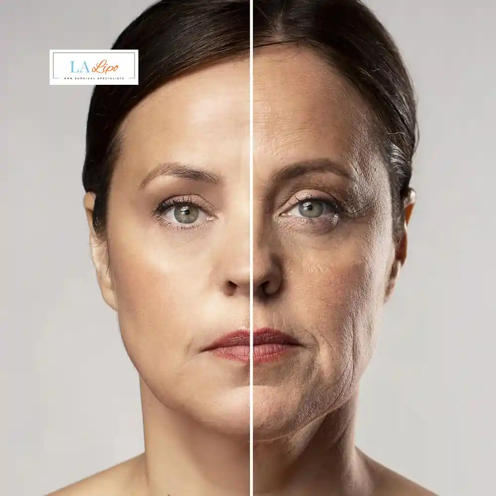 How Can You Tell If Non-Surgical Skin Tightening Is Right for You Greater London (Haringey)?