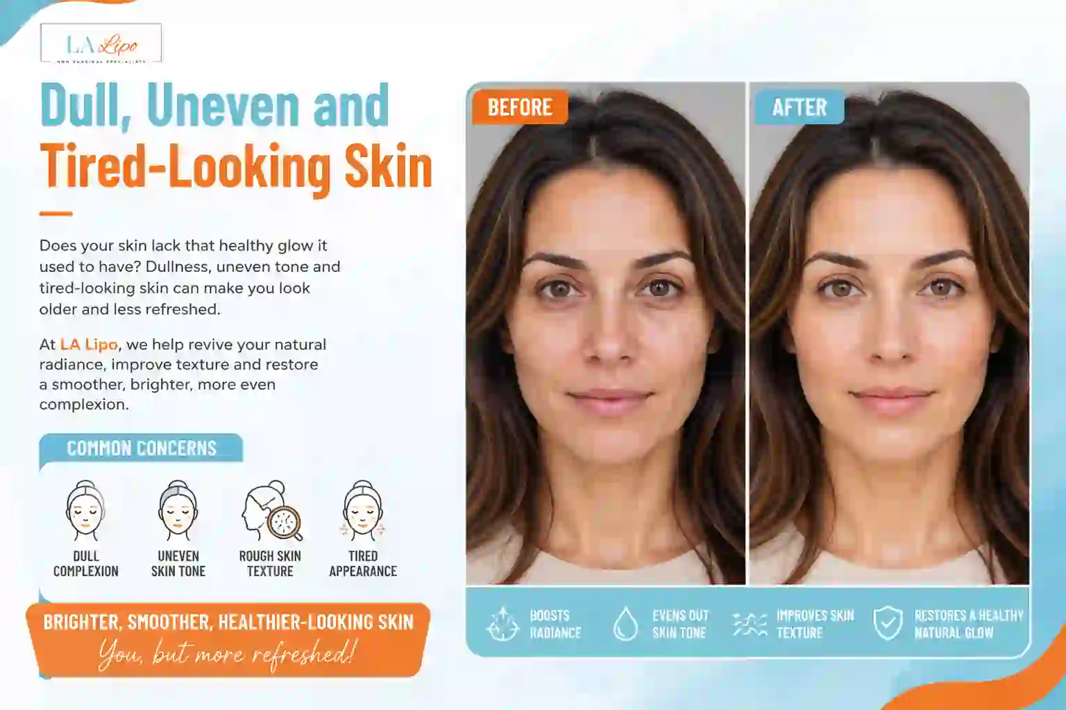 Sign #5: Dull, Uneven and Tired-Looking Skin Greater London (Haringey)