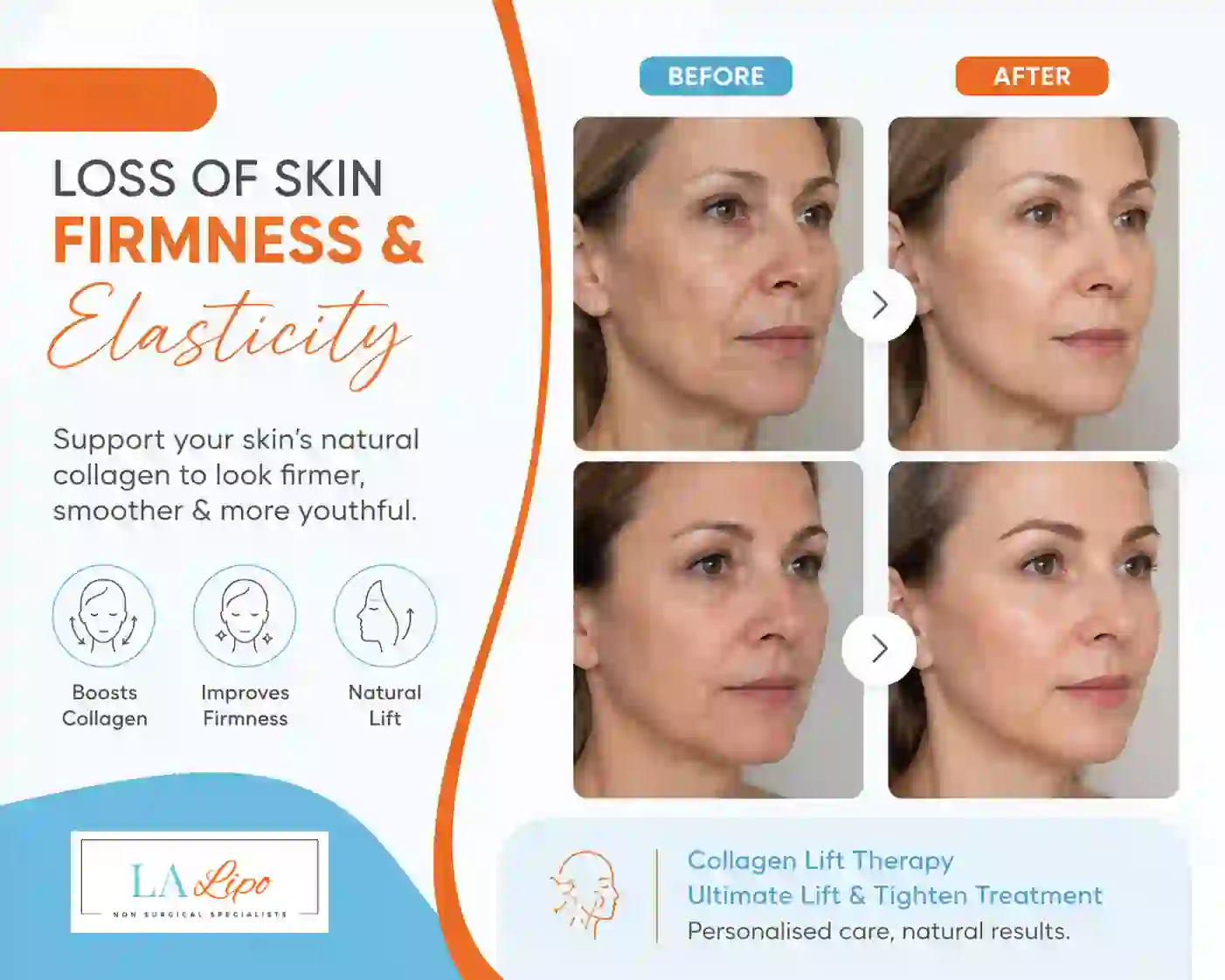 Sign #7: Loss of Skin Firmness and Elasticity Greater London (Haringey)